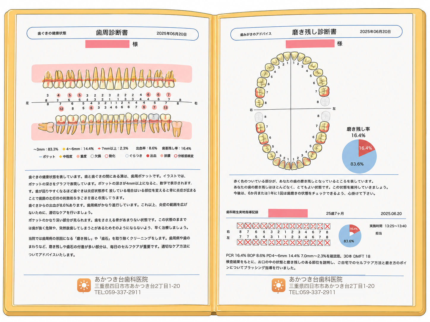 健康手帳の歯周診断書・磨き残し診断書のグラフ